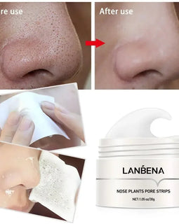 LANBENA Blackhead Remover Pore Strips – Peel-Off Mud Mask for Nose Acne & Pore Cleansing