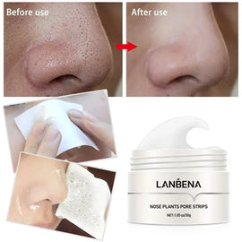 LANBENA Blackhead Remover Pore Strips – Peel-Off Mud Mask for Nose Acne & Pore Cleansing