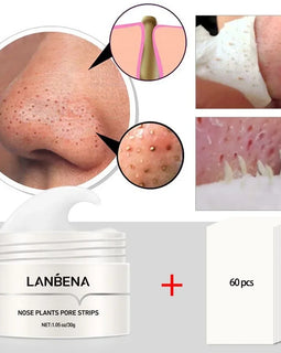 LANBENA Blackhead Remover Pore Strips – Peel-Off Mud Mask for Nose Acne & Pore Cleansing