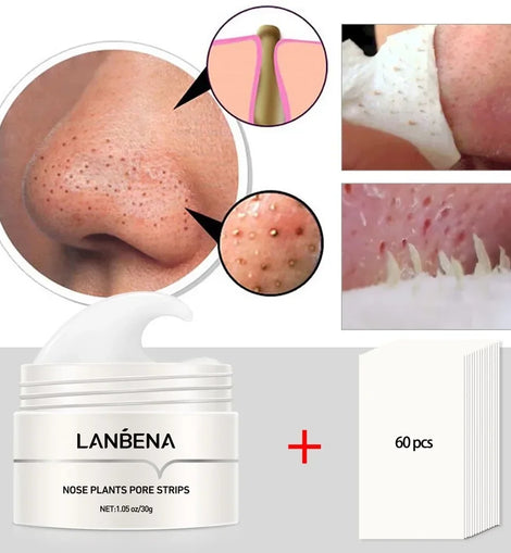 LANBENA Blackhead Remover Pore Strips – Peel-Off Mud Mask for Nose Acne & Pore Cleansing